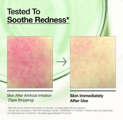 Anua Azelaic Acid 10 Hyaluronic Redness Soothing Serum, Facial Serum for Sensitive Skin, Hyaluronic Acid, Niacinamide, Spot Care, Natural Colour, Vegan, Korean Skincare (30 ml / 1.01 fl oz.)