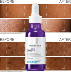 La Roche-Posay Mela B3 Serum, Intense Anti-Dark Spot Face Serum, Hyperpigmentation Treatment, Multi-Patented Melasyl, 10% Niacinamide, Post-Acne Marks Reducer For Sensitive Skin, 30ml